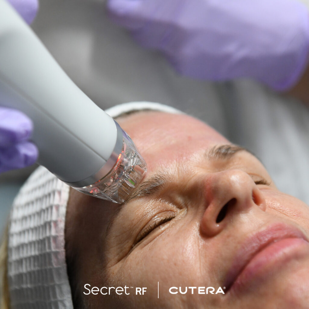 Chicago's Nima Skin Institute now offers Secret RF by Cetera