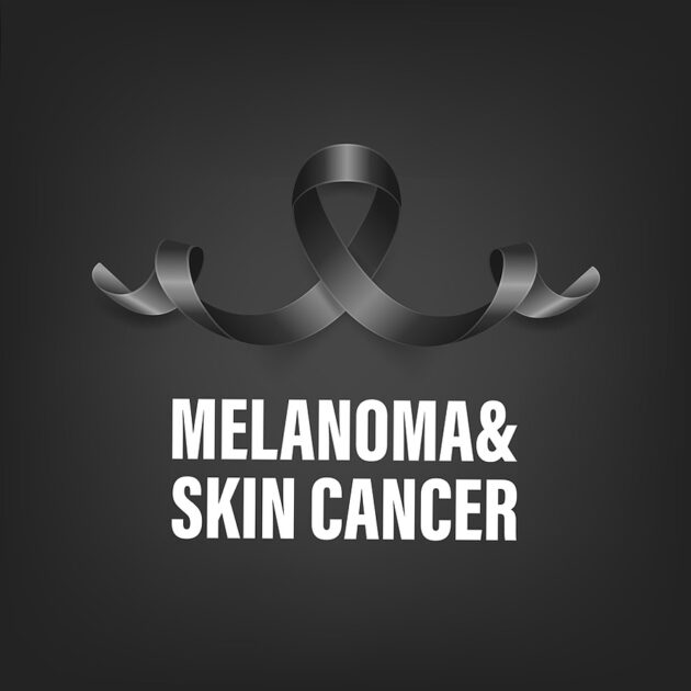 What You Need to Know About Melanoma - Nima Skin Institute